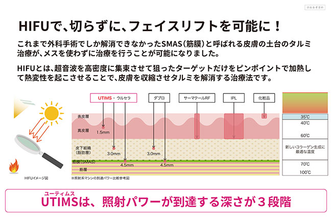 HIFUで、切らずに、フェイスリフトを可能に!