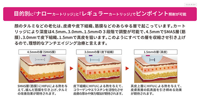 目的別に『ナローカートリッジ』と『レギュラーカートリッジ』でピンポイント照射が可能